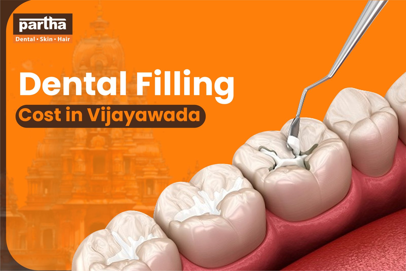 Root canal treatment in