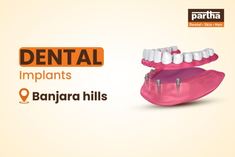 Dental-Implant-Banjara-Hills