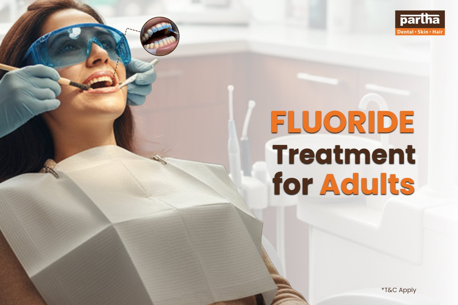 Fluoride Treatment for Adults scaled