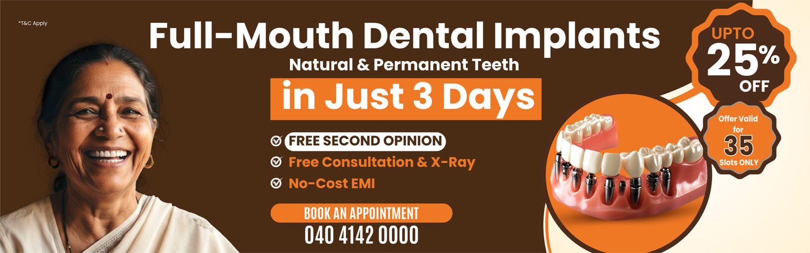 Up To 25% off on Full Mouth Dental Implants
