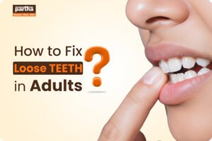 How to Fix Loose Teeth in Adults 1