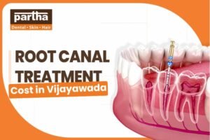RCT in Vijayawada 1