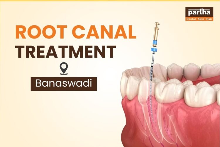 Root Canal Treatment Banaswadi