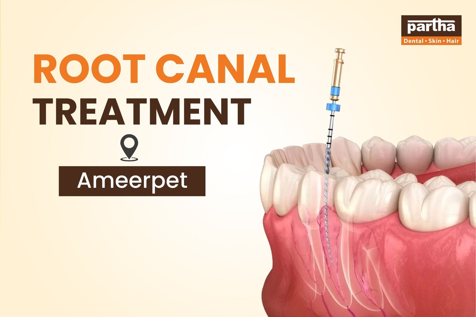 Root canal treatment in Banjara Hills