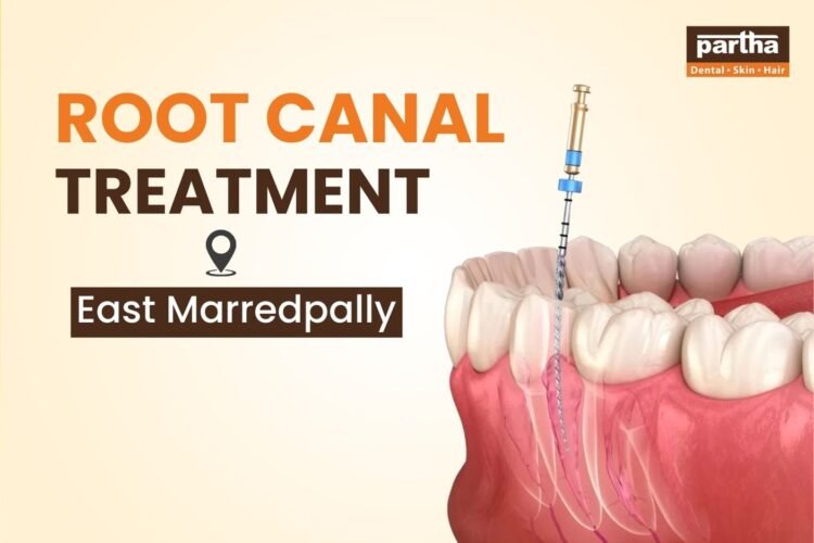 Root Canal Treatment in East Marredpally