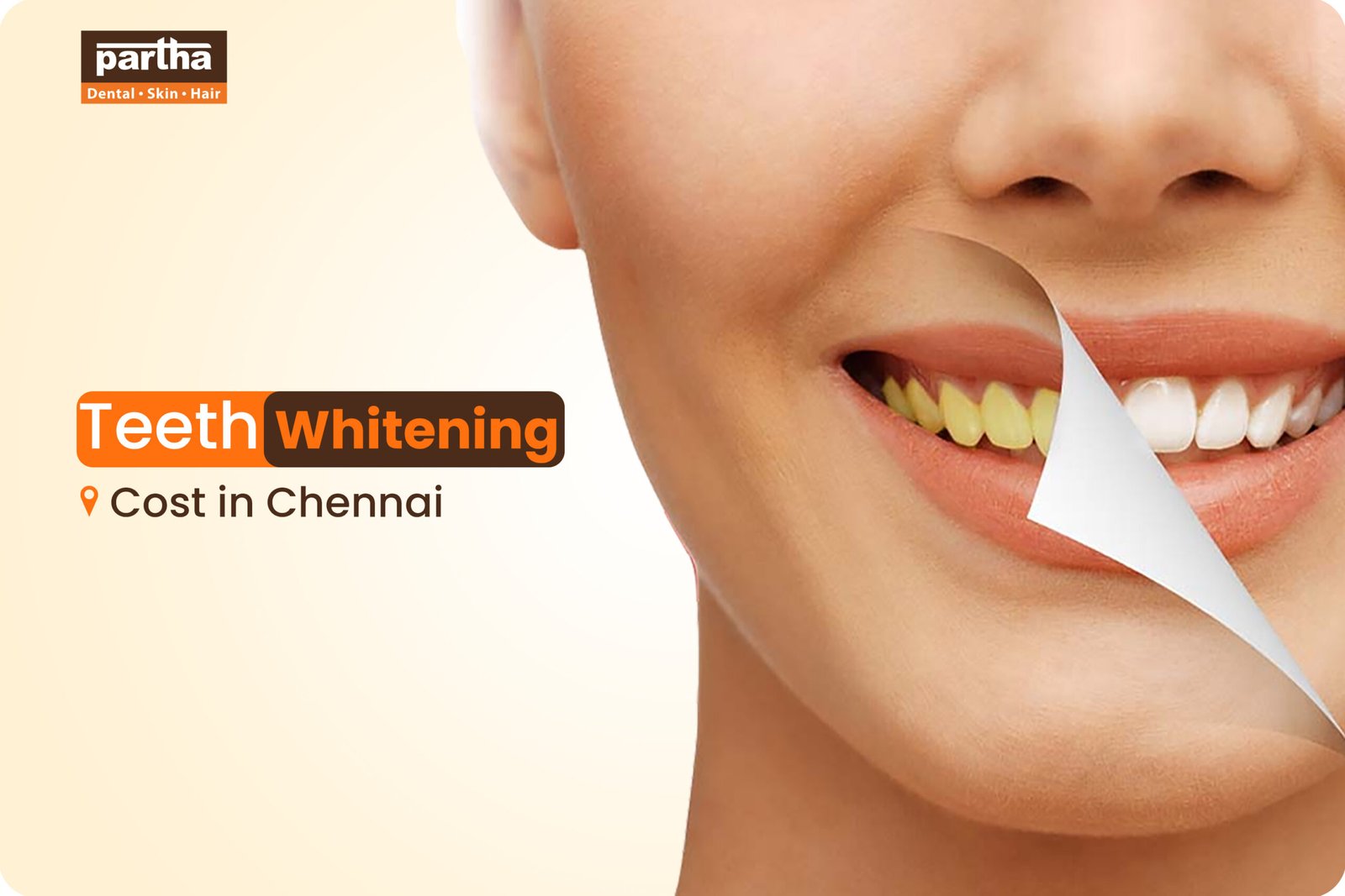 Teeth Whitening Cost in Chennai scaled