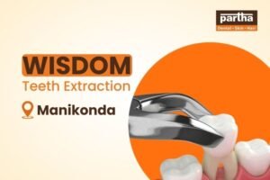 Wisdom-teeth-Extraction-manikonda