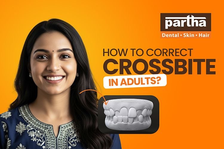 crossbite correction in adults
