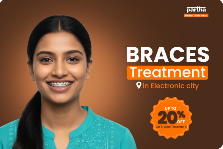 Braces-Treatmeet-Electronic-city