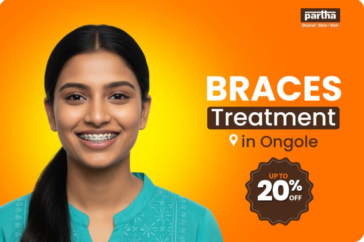 Braces Treatment in Ongole