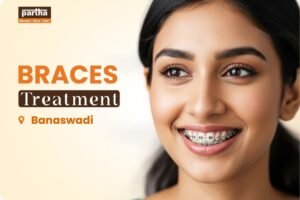 braces-treatment-banaswadi
