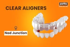 Clear aligners nad junction1