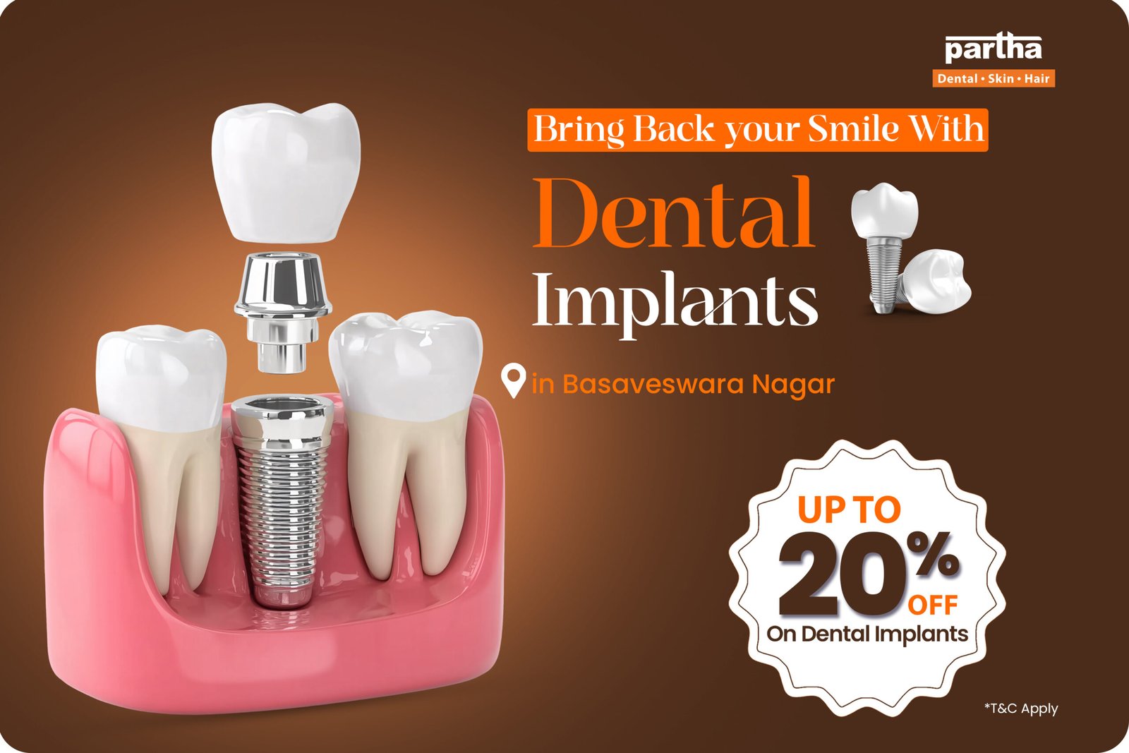 Dental-implant Basaveswara Nagar