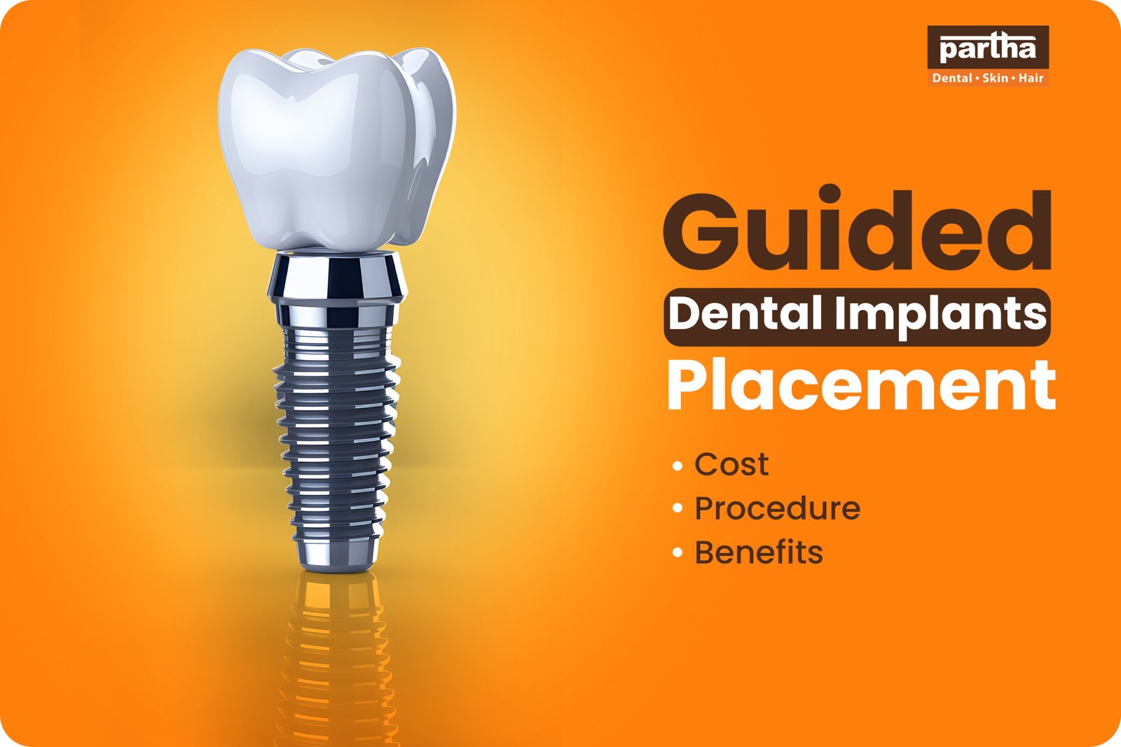 Guided Dental Implants Placement scaled
