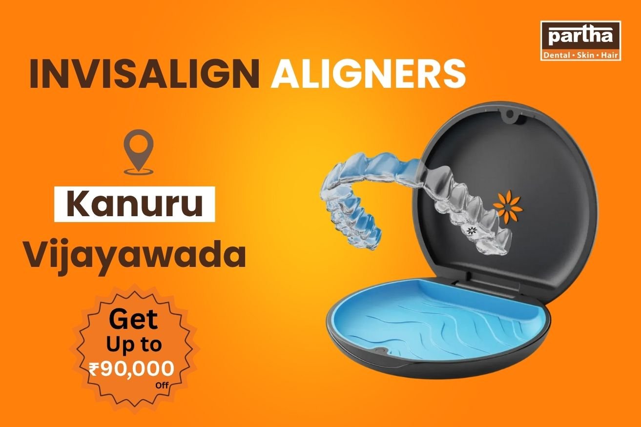 Invisalign aligners in Kanuru