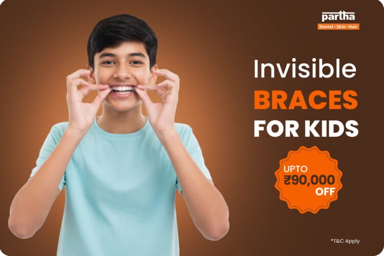 Invisible Braces for Kids