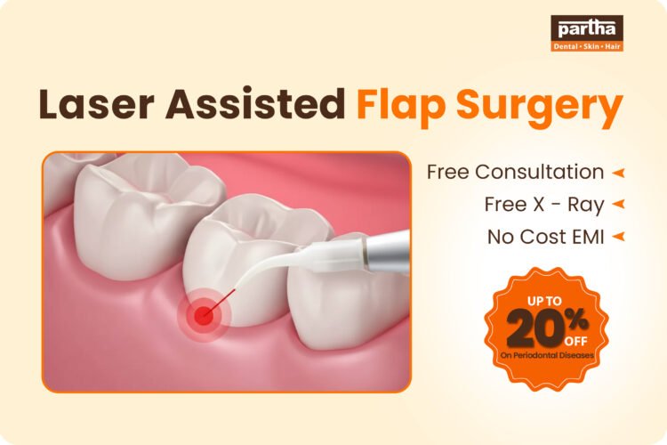 laser assisted flap surgery cost