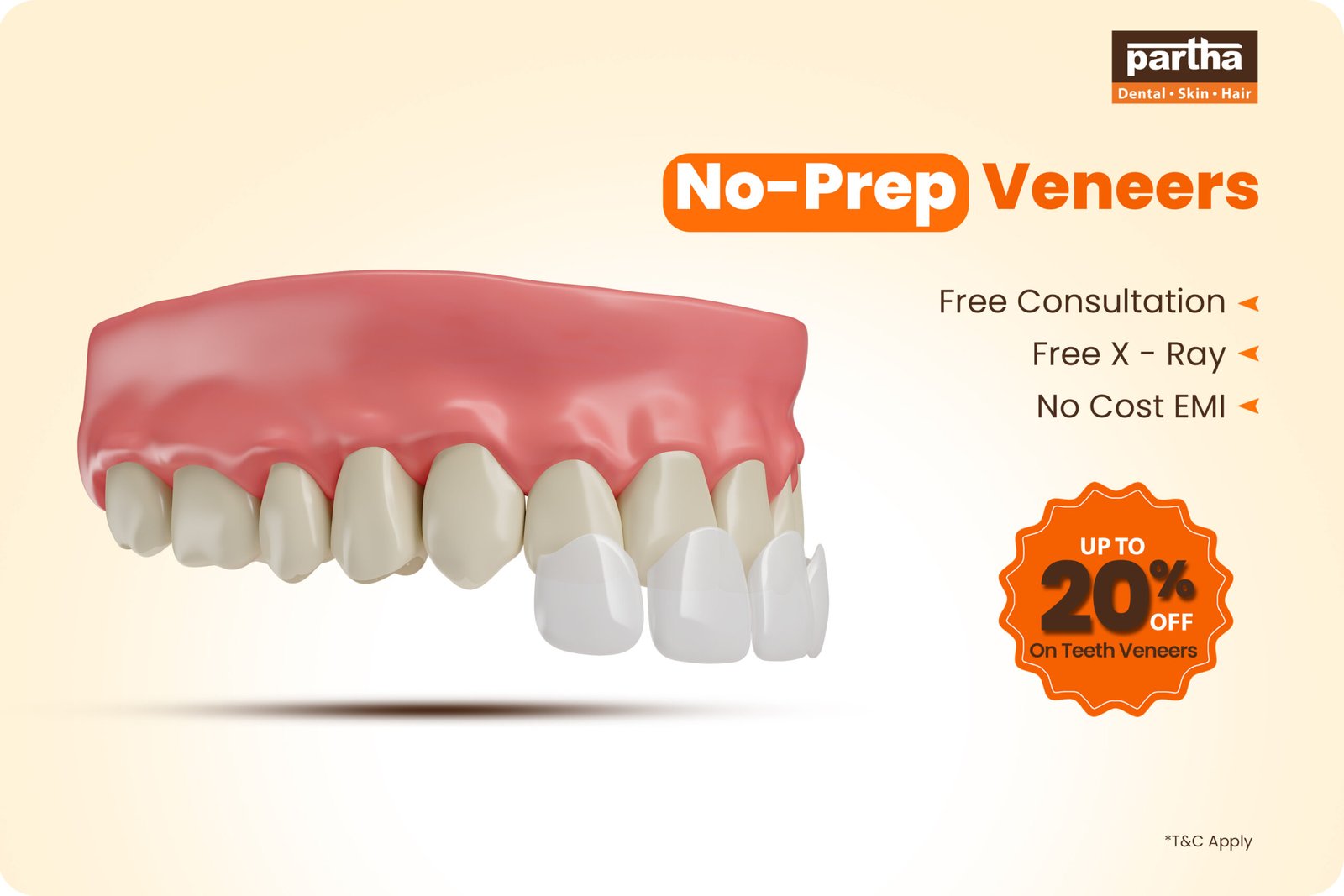 No-Prep Veneers: Cost, Benefits & Procedure 1 No Prep Veneers scaled