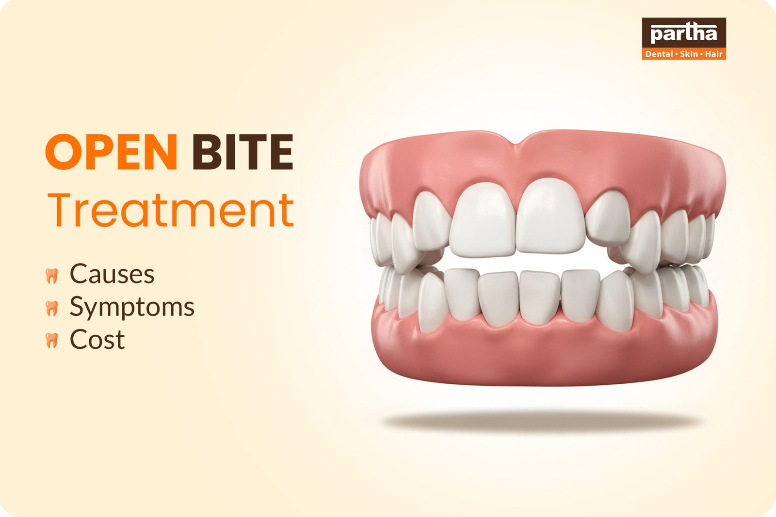 Open Bite Treatment Options scaled
