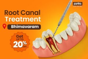 Root Canal Treatment in Bhimavaram