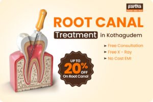 Root Canal Treatment in Kothagudem