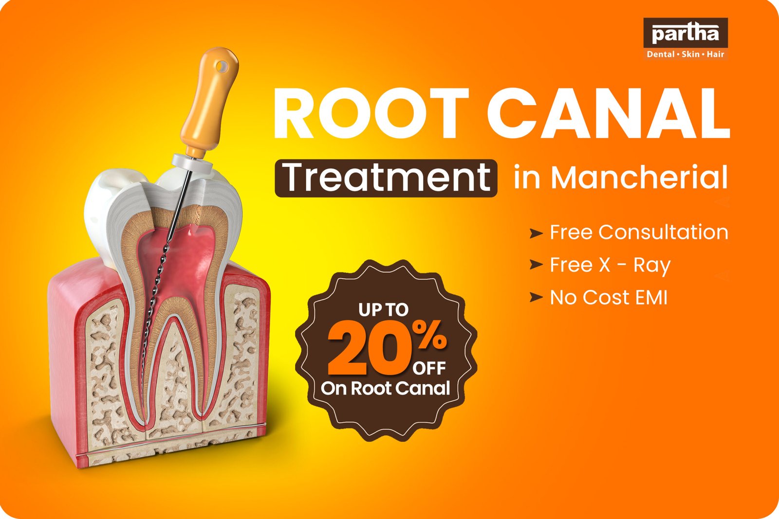 Painless Root Canal Treatment in Mancherial – Up to 20% Off On RCT at Partha Dental 1 Root-Canal-Mancherial