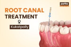Root-canal-Treatment-Kukatpally
