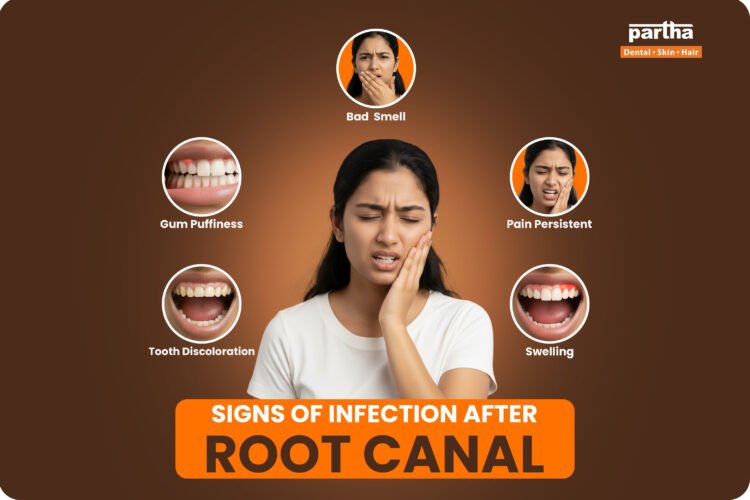 signs of infection after root canal