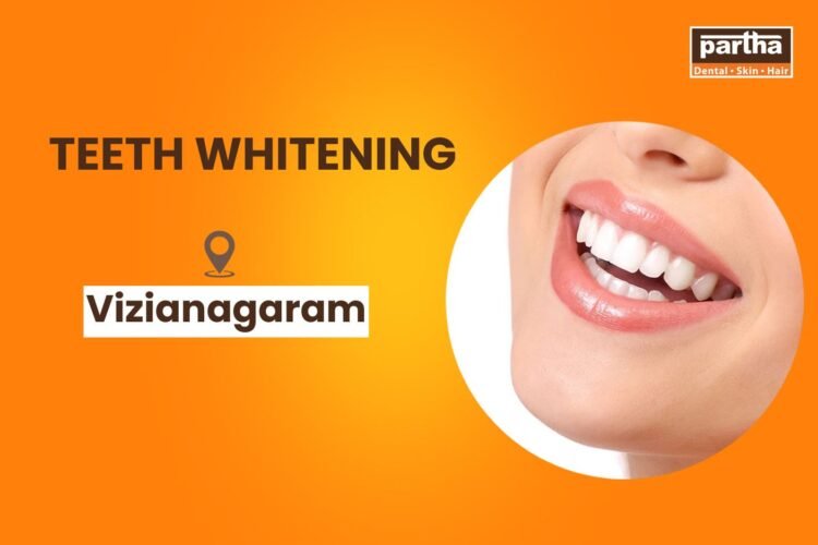 Teeth whitening in Vizianagaram