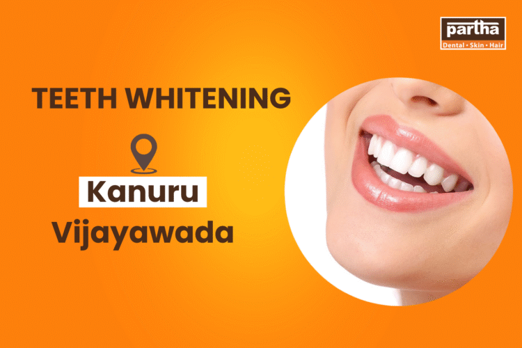 Teeth-whitening-in Kanuru