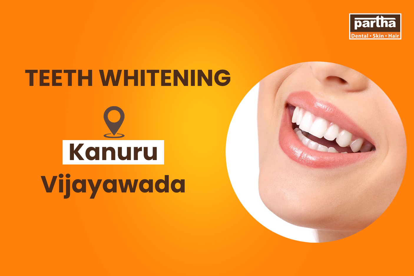 Teeth-whitening-in Kanuru