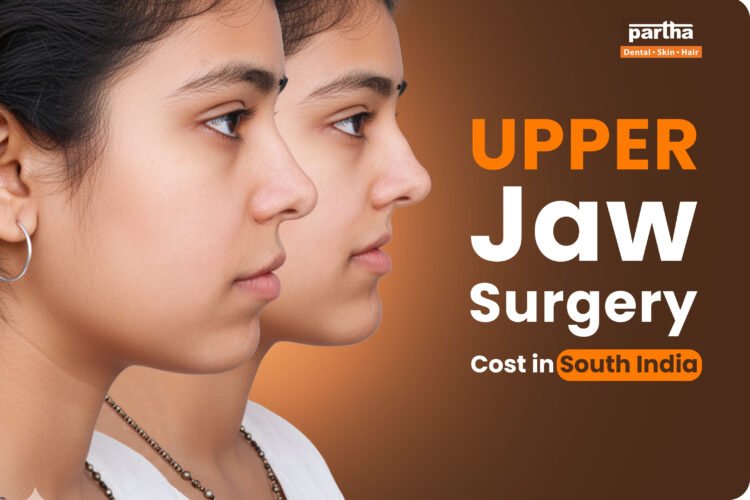 upper jaw surgery cost