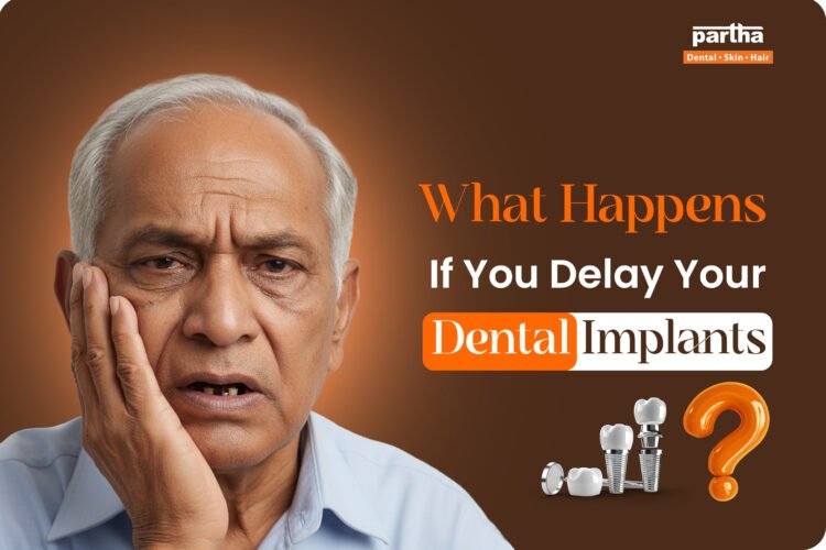 What Happens If You Delay Your Dental Implant Placement?