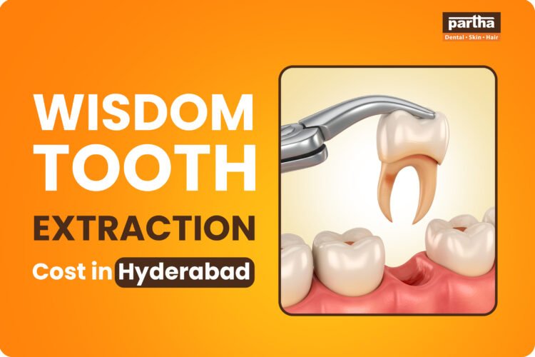 wisdom tooth extraction cost in hyderabad