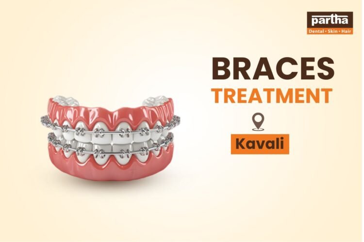 Dental Braces Treatment in Kavali