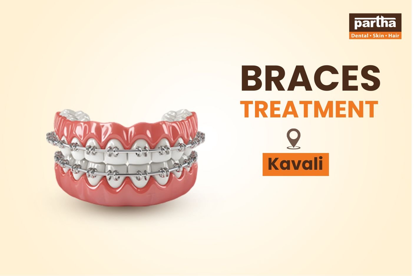 Dental Braces Treatment in Kavali