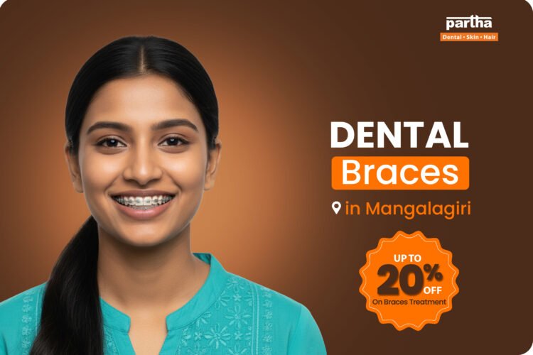 Dental Braces Mangalagiri