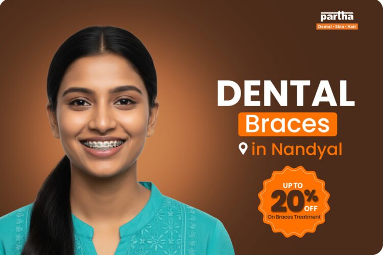 Dental Braces in Nandyal