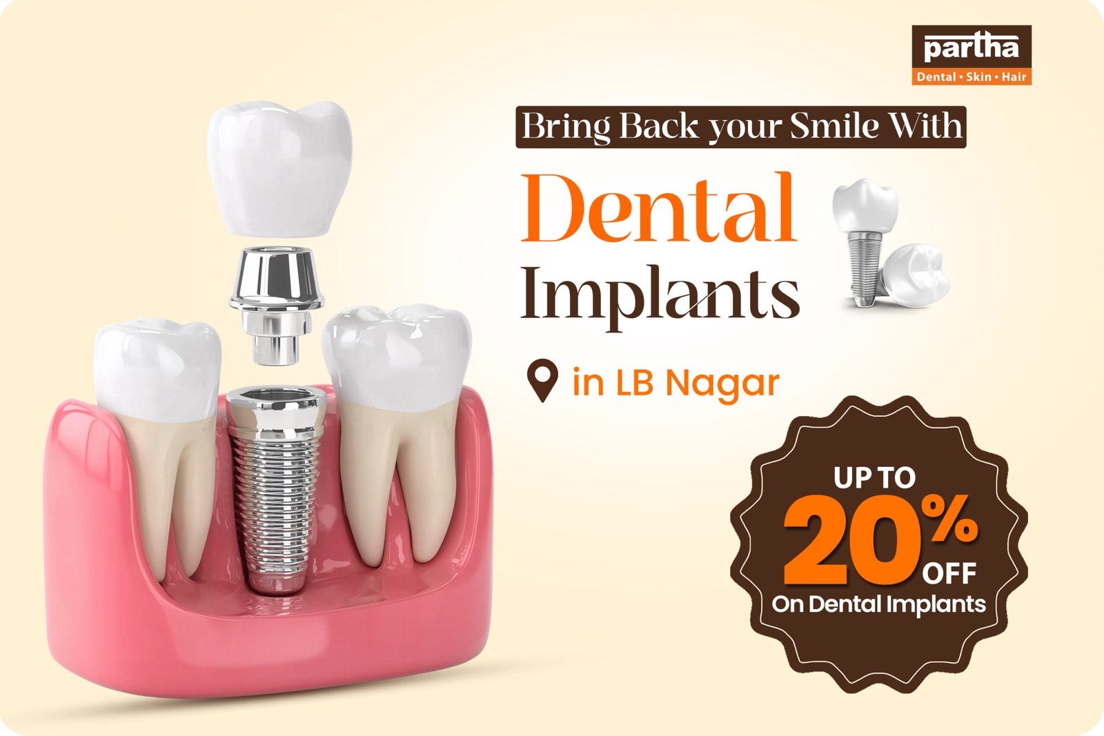 Dental Implants in LB Nagar