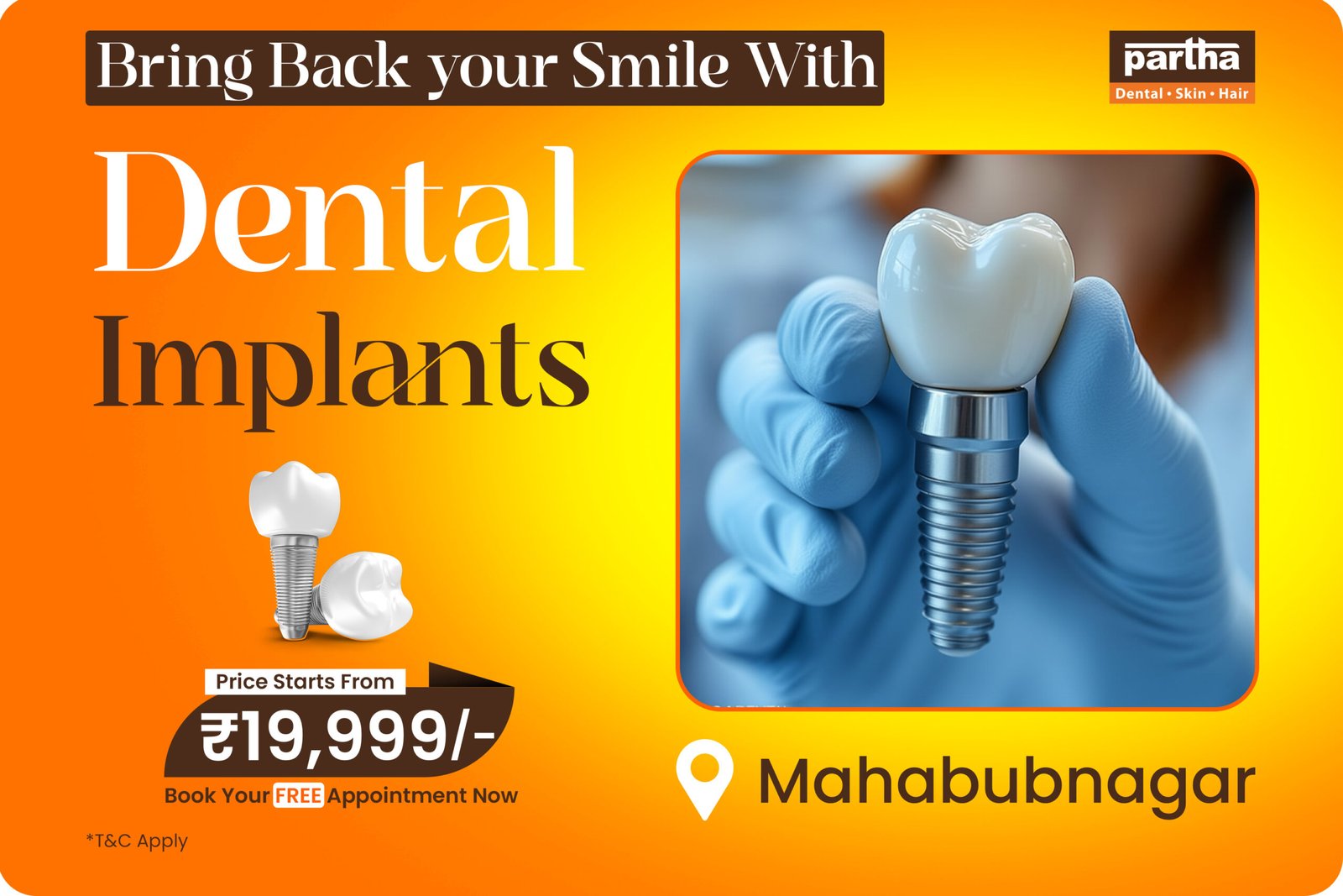Dental implants - Mahabubnagar