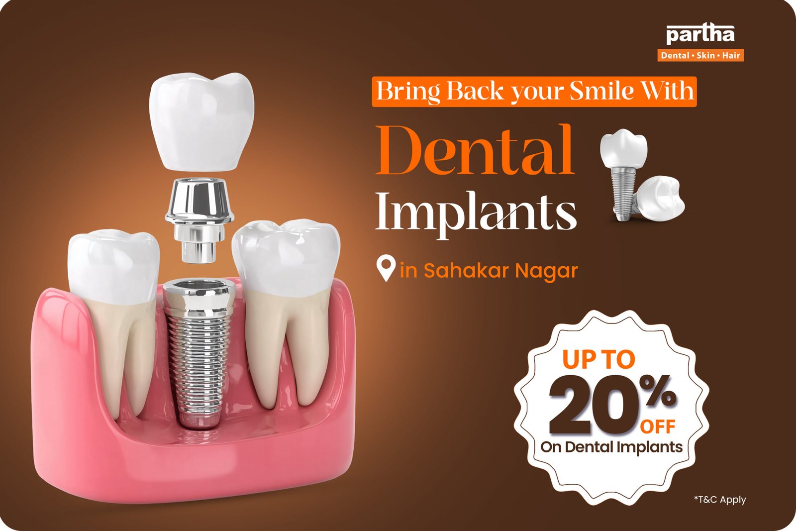 Dental mplants Sahakar Nagar
