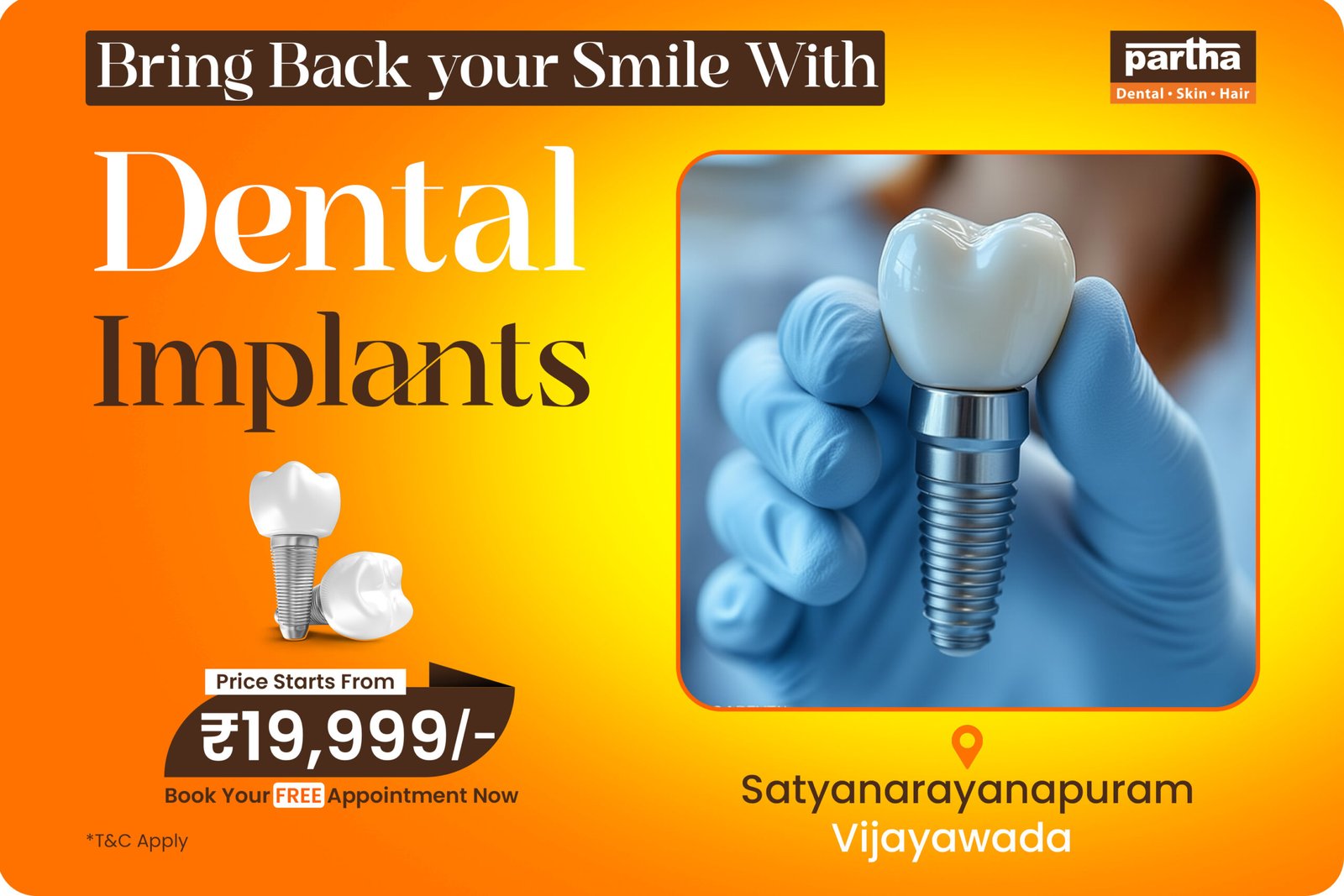 dental implants in satyanarayanapuram