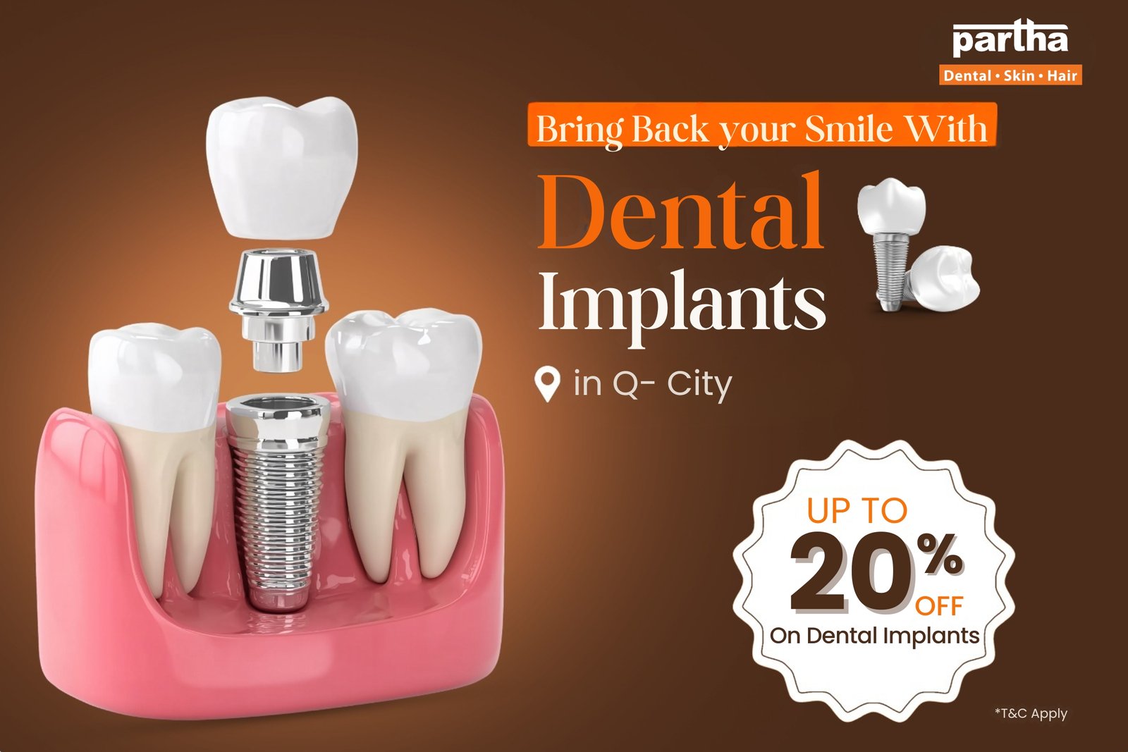 dental-implants-Q-city