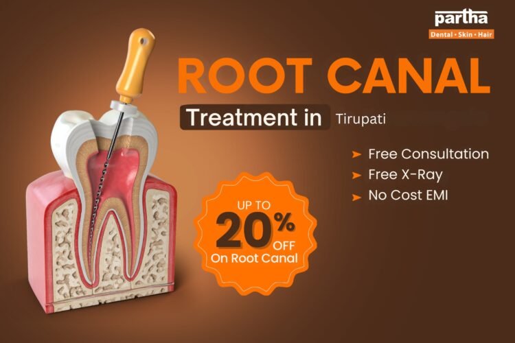 Root Canal Treatment in Tirupati