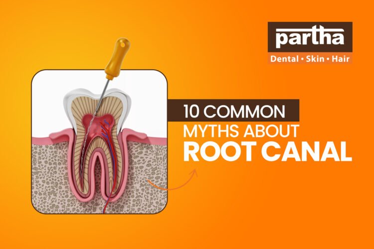 Root Canal Treatments