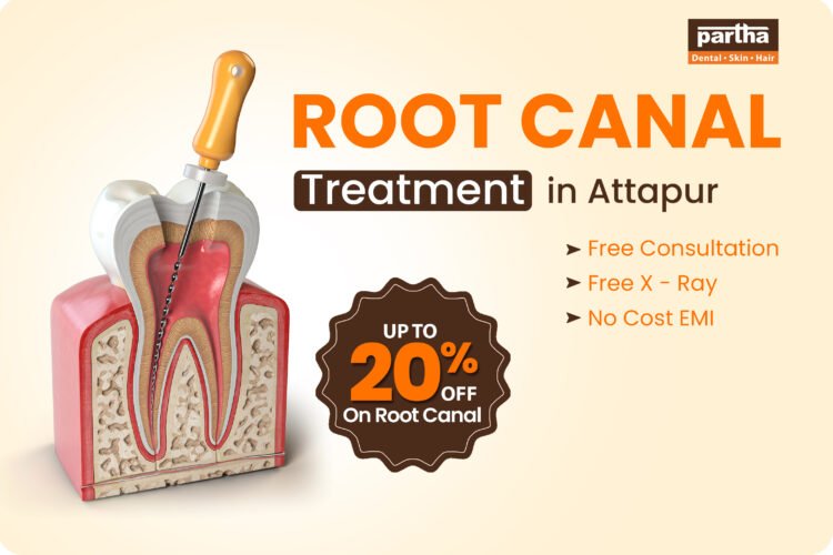 Root Canal Treatment in Attapur