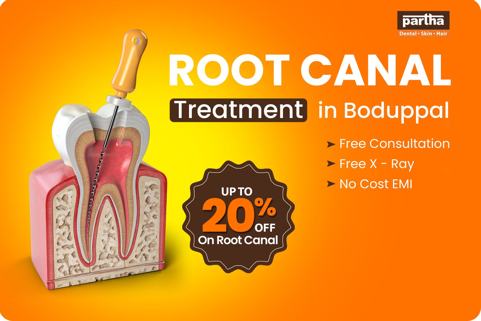 Root Canal-Boduppal