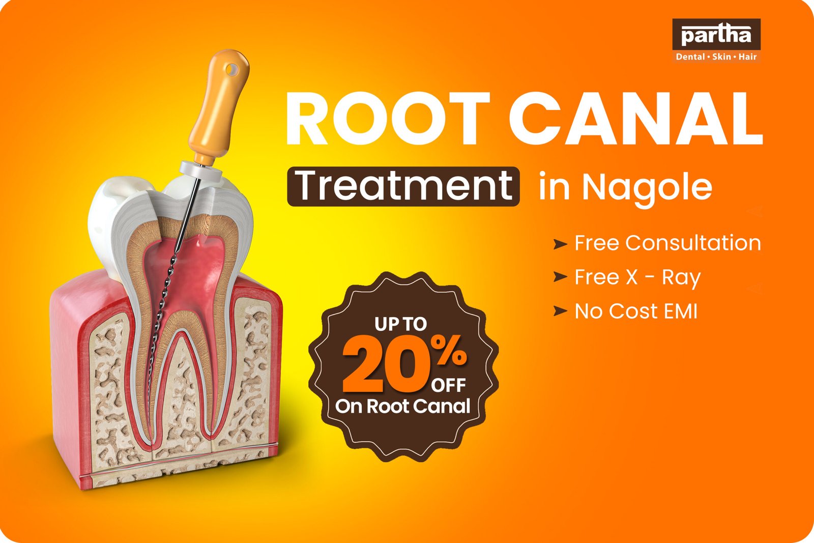 Root Canal Treatment in Nagole
