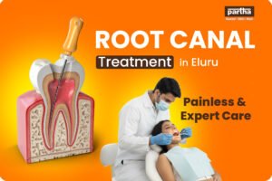 Root Canal Treatment in Eluru