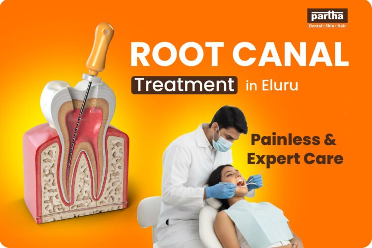 Root Canal Treatment in Eluru